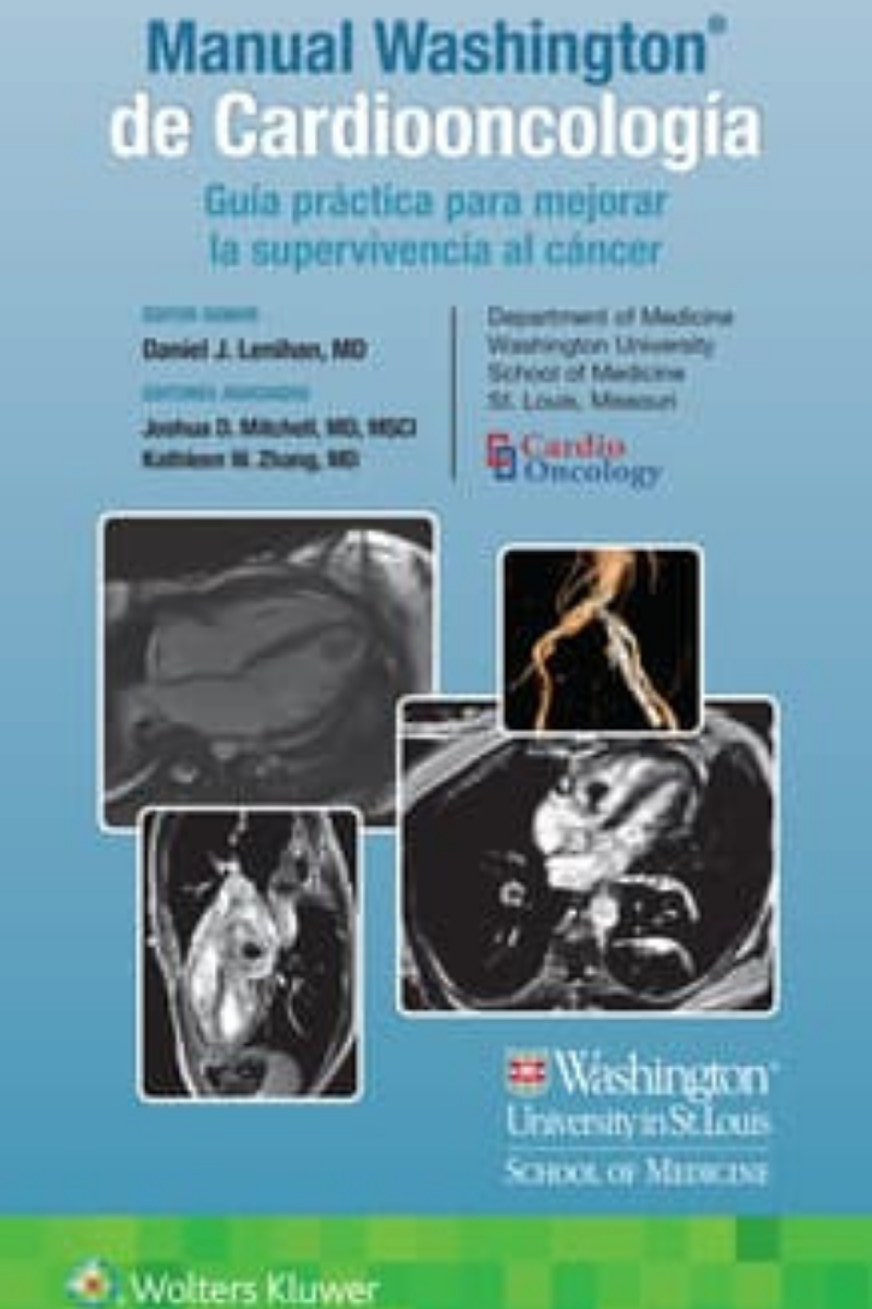 MANUAL WASHINGTON DE CARDIOONCOLOGIA. GUÍA PRACTICA PARA MEJORAR LA SUPERVIVENCI