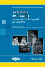 RADIOLOGÍA DE LA MAMA