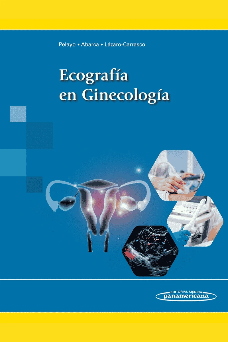 ECOGRAFÍA EN GINECOLOGÍA