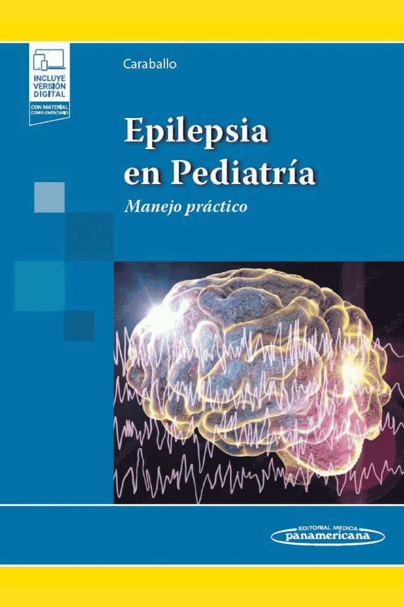 EPILEPSIA EN PEDIATRÍA